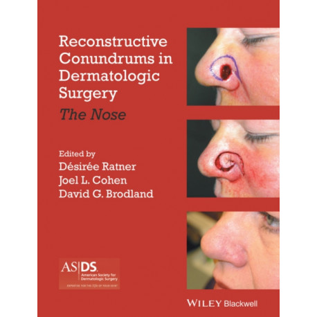 Reconstructive Conundrums in Dermatologic Surgery: The Nose