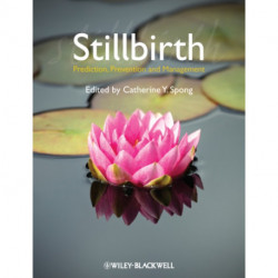 Stillbirth: Prediction, Prevention and Management
