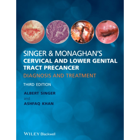 Singer and Monaghan's Cervical and Lower Genital Tract Precancer: Diagnosis and Treatment