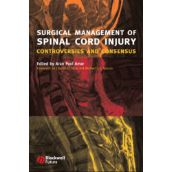 Surgical Management of Spinal Cord Injury: Controversies and Consensus