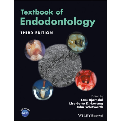 Textbook of Endodontology