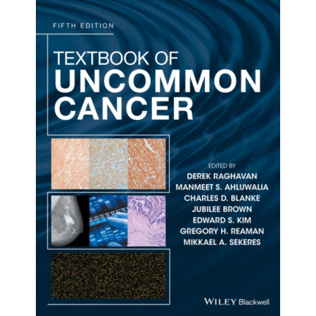 Textbook of Uncommon Cancer