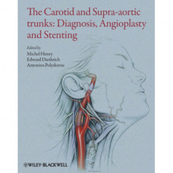 The Carotid and Supra-Aortic Trunks: Diagnosis, Angioplasty and Stenting