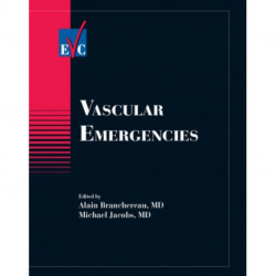 Vascular Emergencies