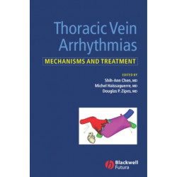 Thoracic Vein Arrhythmias: Mechanisms and Treatment