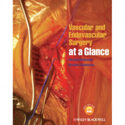 Vascular and Endovascular Surgery at a Glance