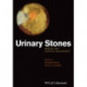 Urinary Stones: Medical and Surgical Management