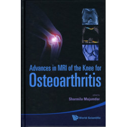 Advances In Mri Of The Knee For Osteoarthritis