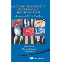 Allograft Procurement, Processing And Transplantation: A Comprehensive Guide For Tissue Banks