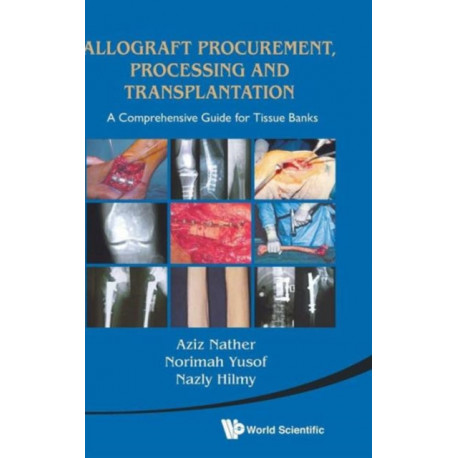 Allograft Procurement, Processing And Transplantation: A Comprehensive Guide For Tissue Banks