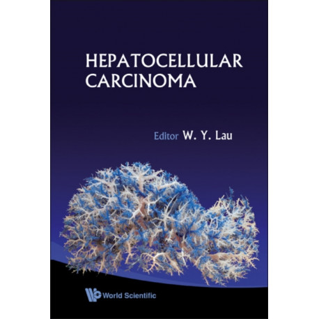 Hepatocellular Carcinoma