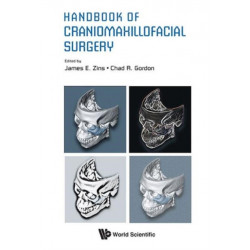 Handbook Of Craniomaxillofacial Surgery