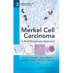 Merkel Cell Carcinoma: A Multidisciplinary Approach