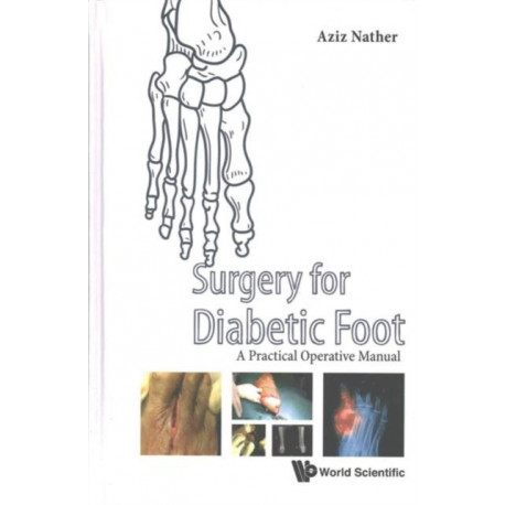 Surgery For Diabetic Foot: A Practical Operative Manual