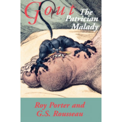 Gout: The Patrician Malady