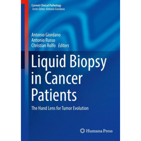 Liquid Biopsy in Cancer Patients: The Hand Lens for Tumor Evolution