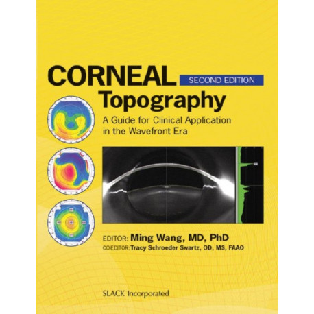 Corneal Topography: A Guide for Clinical Application in Wavefront Era