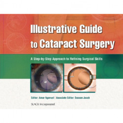 Illustrative Guide to Cataract Surgery: A Step-by-Step Approach to Refining Surgical Skills