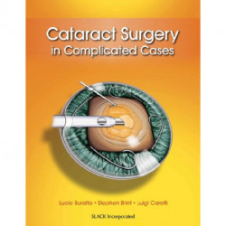 Cataract Surgery in Complicated Cases