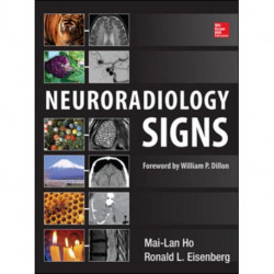 Neuroradiology Signs