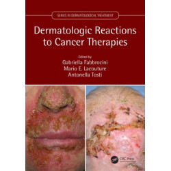 Dermatologic Reactions to Cancer Therapies