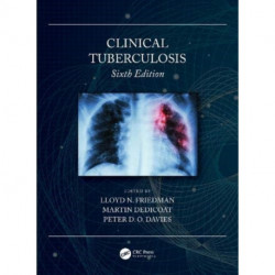 Clinical Tuberculosis