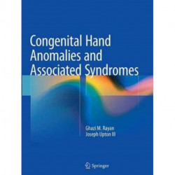 Congenital Hand Anomalies and Associated Syndromes