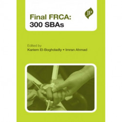 Final FRCA: 300 SBAs