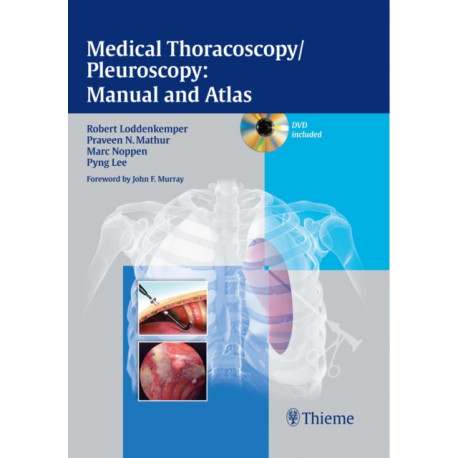 Medical Thoracoscopy / Pleuroscopy: Manual and Atlas