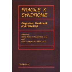 Fragile X Syndrome: Diagnosis, Treatment, and Research