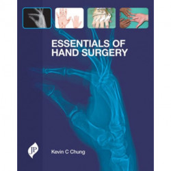 Essentials of Hand Surgery