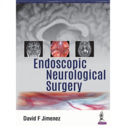 Endoscopic Neurological Surgery
