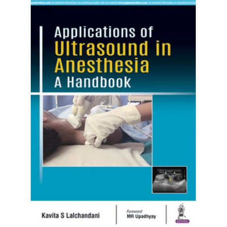 Applications of Ultrasound in Anesthesia: A Handbook