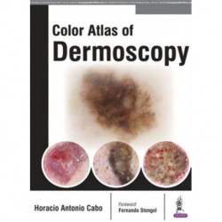 Color Atlas of Dermoscopy