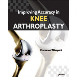 Improving Accuracy in Knee Arthroplasty