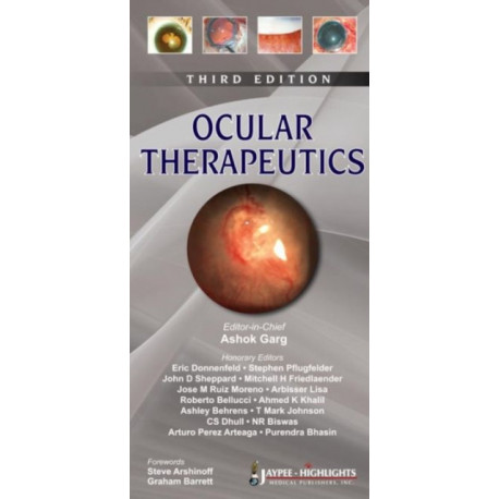 Ocular Therapeutics