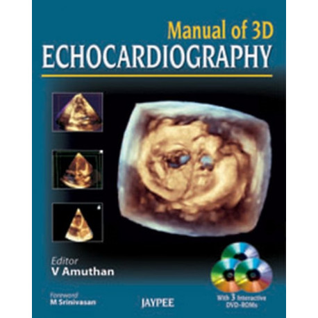 Manual of 3D Echocardiography