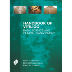 Handbook of Vitiligo: Basic Science and Clinical Management