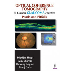 Optical Coherence Tomography in Current Glaucoma Practice: Pearls and Pitfalls