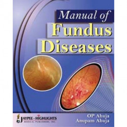 Manual of Fundus Diseases