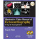 Illustrative Video Manual of Echocardiography: A Step by Step Approach - Part 2