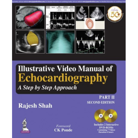 Illustrative Video Manual of Echocardiography: A Step by Step Approach - Part 2