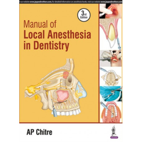 Manual of Local Anaesthesia in Dentistry