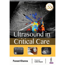 Ultrasound in Critical Care