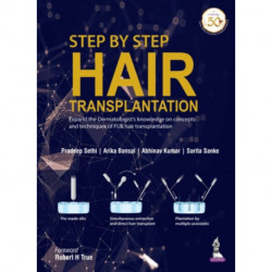 Step by Step Hair Transplantation