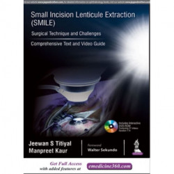Small Incision Lenticule Extraction (SMILE): Surgical Technique and Challenges: Comprehensive Text and Video Guide