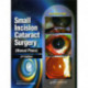 Small Incision Cataract Surgery (Manual Phaco)