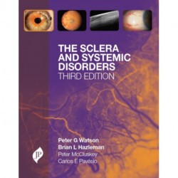 The Sclera and Systemic Disorders