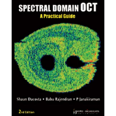 Spectral Domain OCT: A Practical Guide