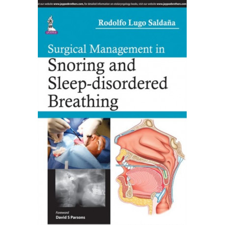 Surgical Management in Snoring and Sleep-disordered Breathing